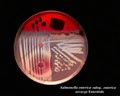 salmonella enterica